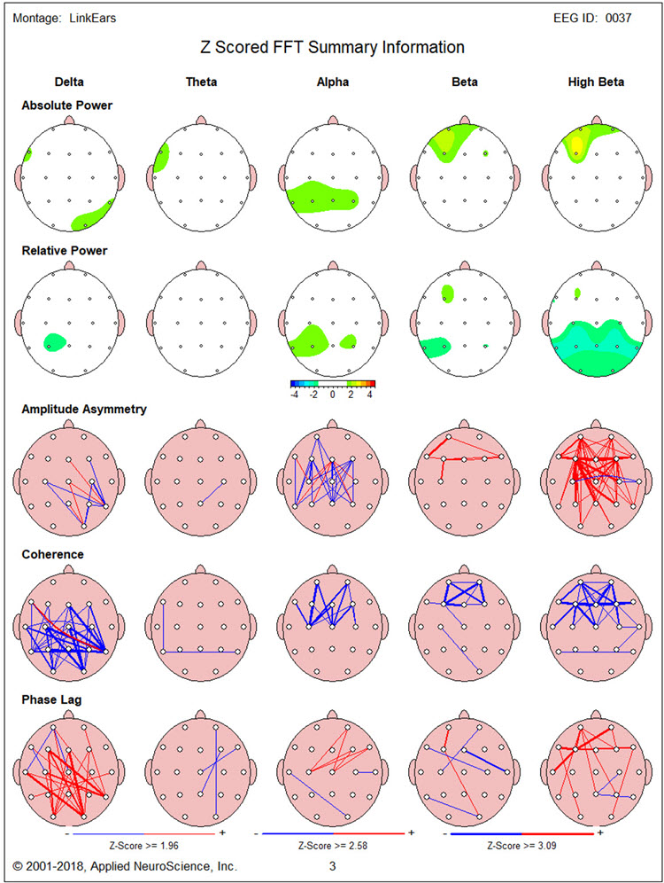 Figure 15 - Post-neurofeedback eyes-closed NeuroGuide z-score FFT summary report